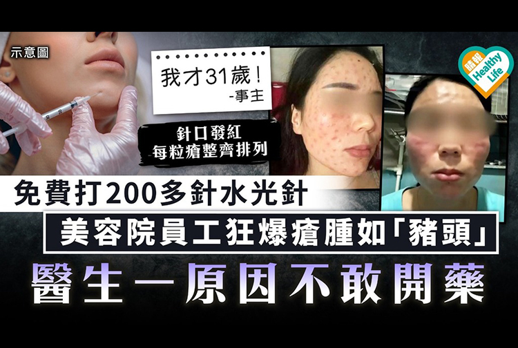 護膚就像做運動那樣,要長久建立的,一時貪快就會有以下效果風險,和要了解自己皮膚膚質是否屬於敏感肌膚