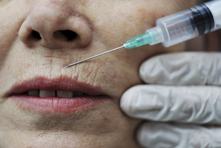 衛生防護中心公布,正調查一宗在韓國首爾注射肉毒桿菌毒素後出現肉毒中毒的疑似個案,涉及一名25歲女病人。